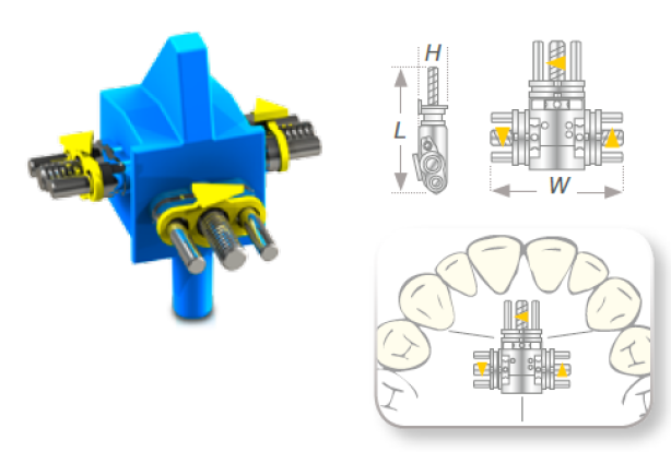 Винт ортодонтический Vector 730